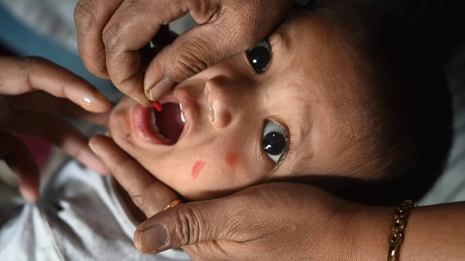 India's Measles Outbreak Exceeds 73,000 Cases