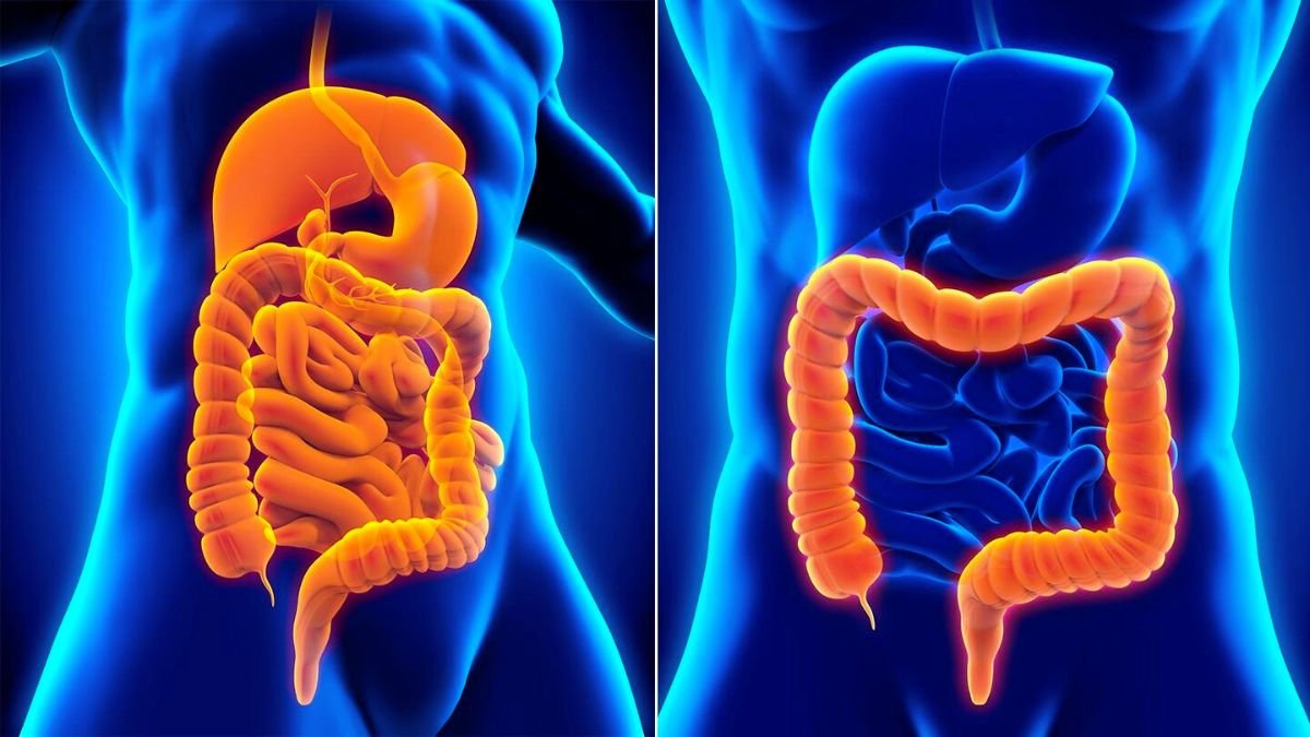 Difference between Ulcerative Colitis and Crohn's Disease
