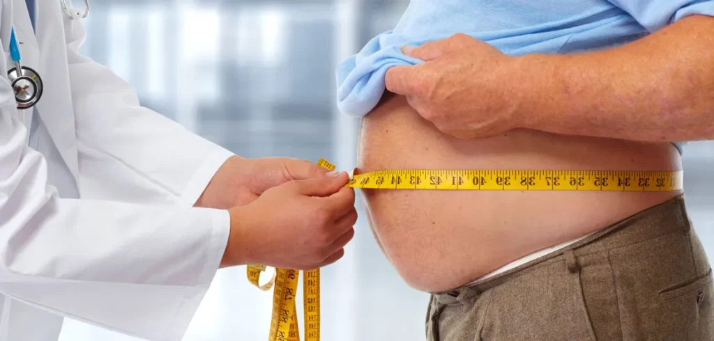Morbid Obesity ICD 10